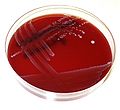 Blood agar with Enterococcus faecalis